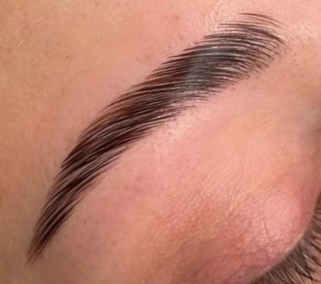 Browlifting