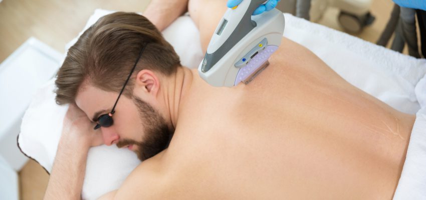 Men lying at beautician's during laser back hair removal therapy